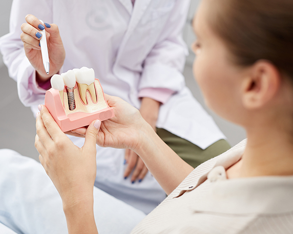 Implantes dentários têm garantia? Como funciona? - Imagem Closeup de médica irreconhecível apontando para o modelo do dente enquanto consultava o paciente, copie o espaço